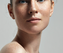 woman with freckles